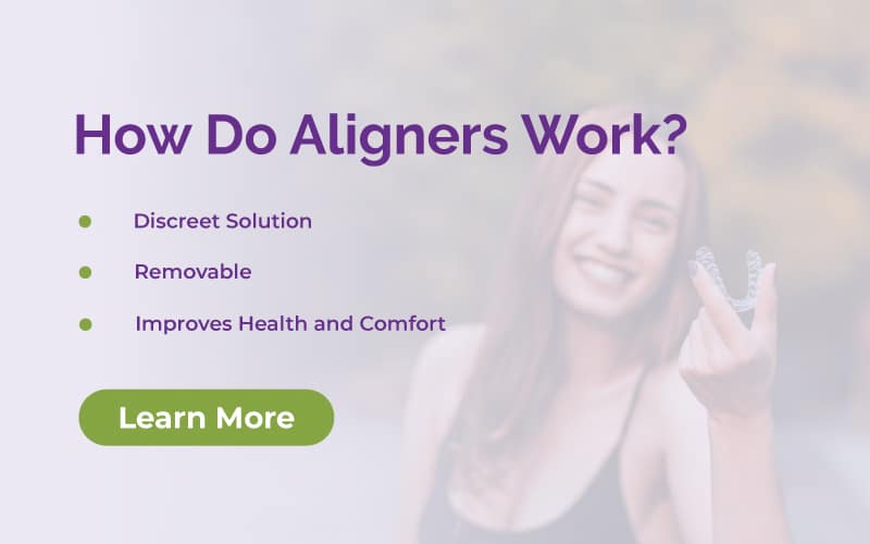 how do aligners work