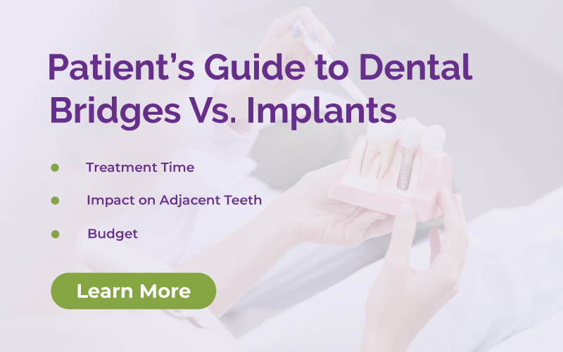 Patient’s Guide to Dental Bridges Vs. Implants