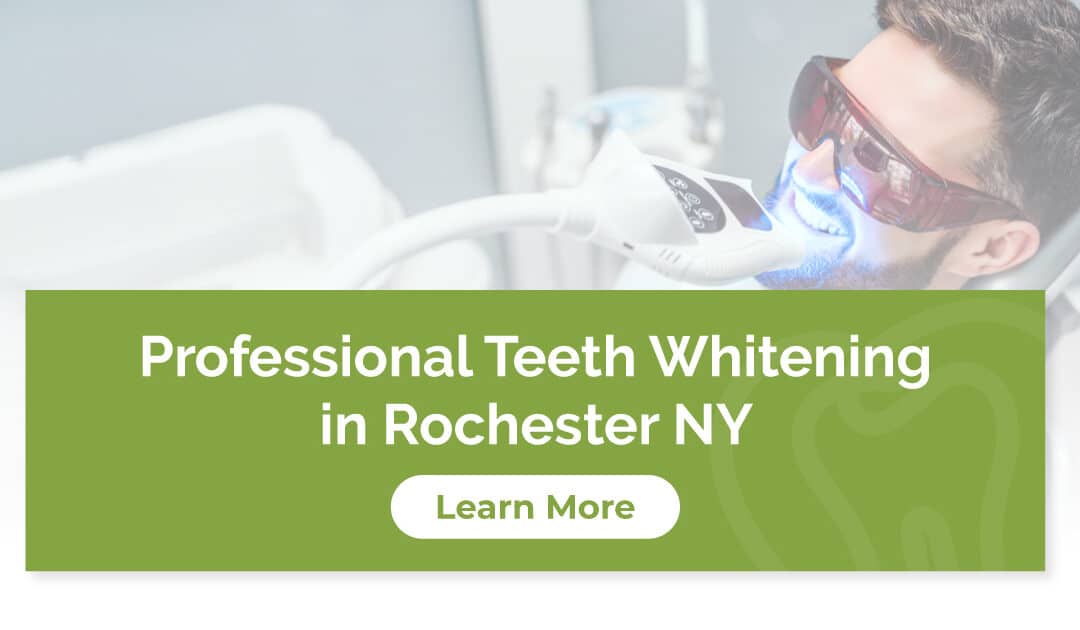 Is It Worth It? Professional Teeth Whitening in Rochester NY