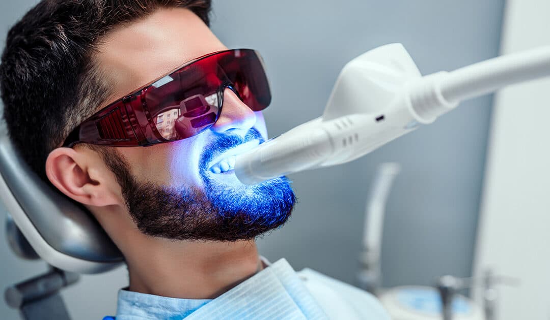 Can a Dentist Whiten Teeth? All About Professional Whitening