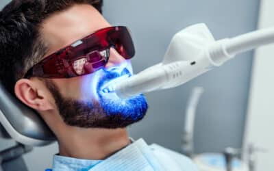 Can a Dentist Whiten Teeth? All About Professional Whitening