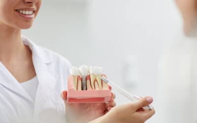 Dental Crown Replacements: What to Expect