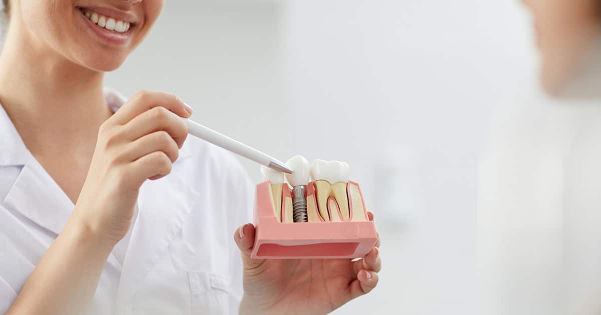 types of dental implants