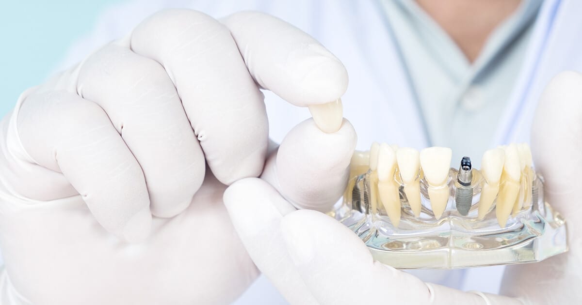 dentist holding a denture model