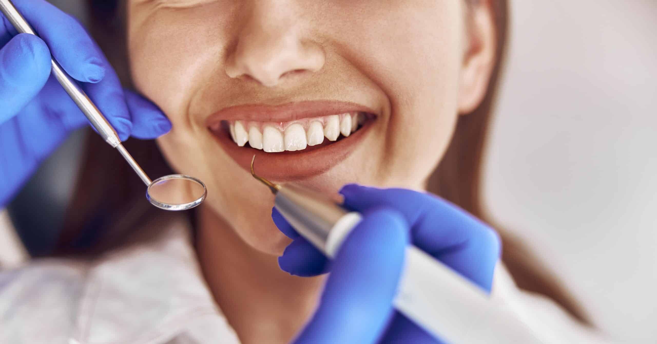 gum disease Rochester