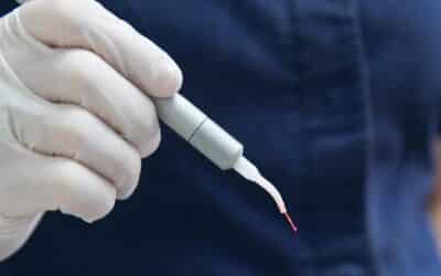What to Expect Before, During & After a LANAP Procedure