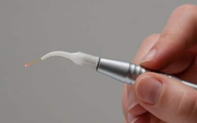 LANAP Benefits: Is Laser Gum Treatment Right for You?