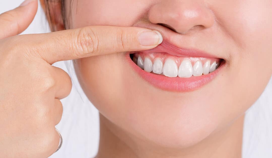 Gum Disease Health Risks That Go Beyond Your Mouth