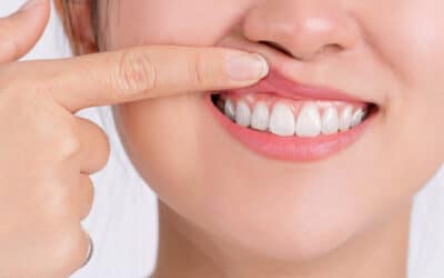 Gum Disease Health Risks That Go Beyond Your Mouth