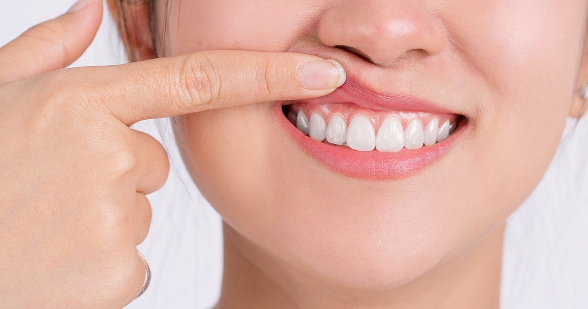 gum disease health risks