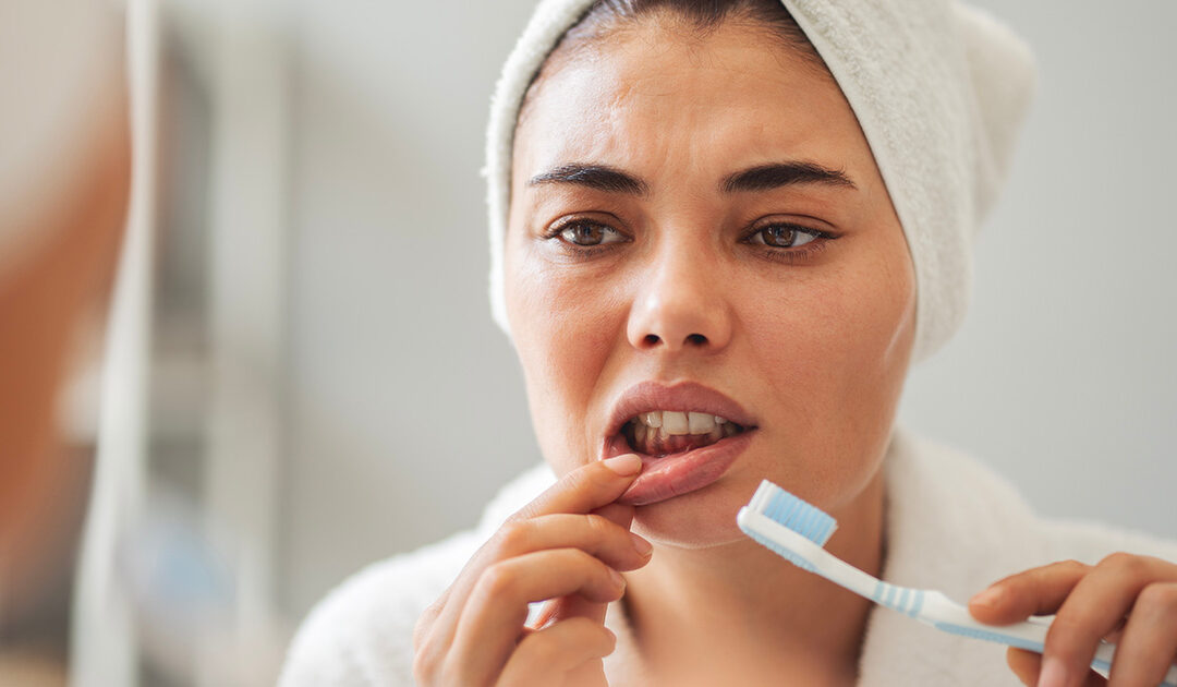 Bleeding Gums? Rochester Dentists Share What It Means