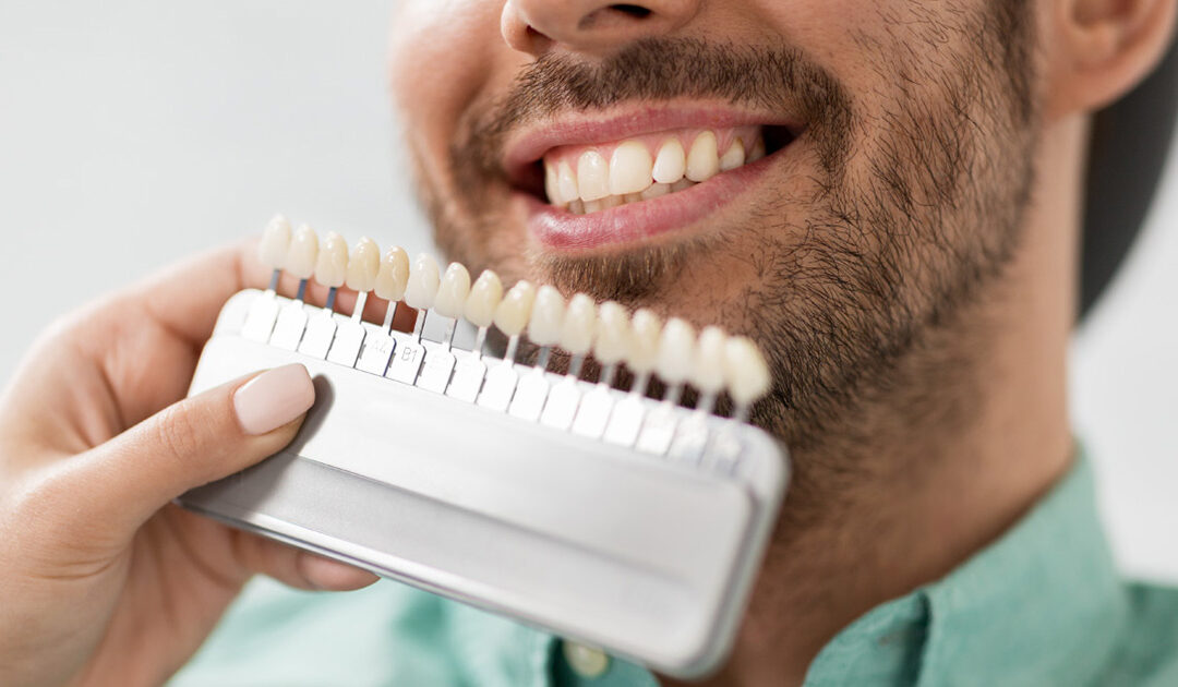 Cosmetic Dentistry: Achieving Your Best Smile in Rochester