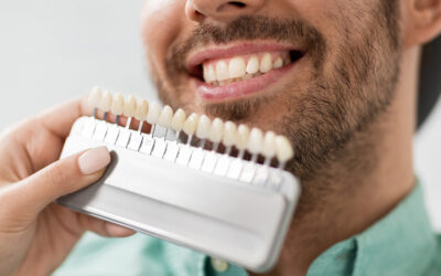 Cosmetic Dentistry: Achieving Your Best Smile in Rochester