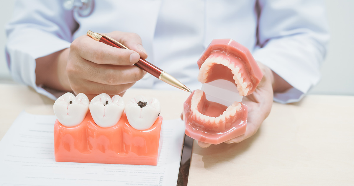 A dentist's hand holding dentures and a pen
