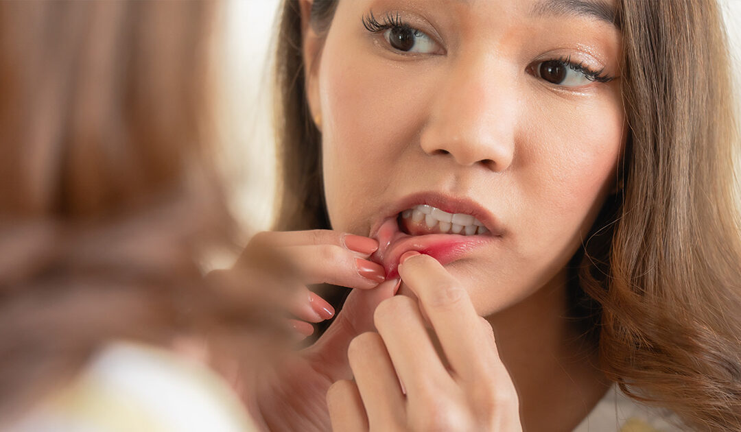 Are My Gums Receding? Signs, Causes, and What to Watch For
